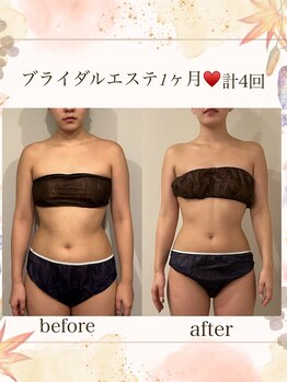 マージェ(magie)/ブライダルエステ