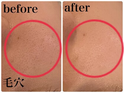 エヌインスキンケアスタジオ 天神店 N-inスキンケアスタジオの写真