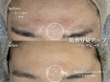 コウル 川西能勢口店(geoul)/毛穴レス美肌コース4回