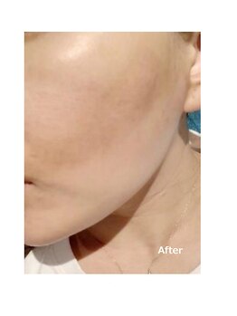 ウル(Ulu)/毛穴が気になったらコレ！