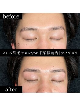 ユー 千葉駅前店(you)/ビフォ－アフター写真