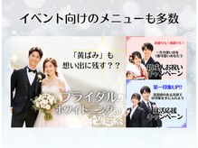 ホワイトニングショップ 多摩店の雰囲気（一生の思い出写真に「黄ばみ」も残す？？あなたの歯白くなります）