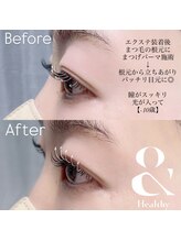 ビューティーグロウ(BEAUTY-GROW)/