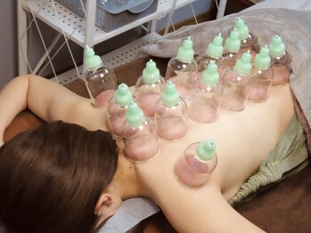 はりめぐりの写真/ほぐしだけでは物足りない方に！カッピングでデトックス！老廃物の排出を促進！鍼灸とのセットメニュー登場