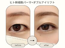 アイビューティー 三荻野店(AI beauty)の雰囲気（続けるたび太さUP!ダブルアイリフトのセットで瞼のダイエットも!）