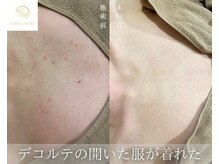 サードプレイス(3rd Place)/2階：エステ症例