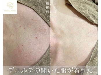 サードプレイス(3rd Place)/2階：エステ症例