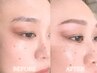 【まゆげ+お顔1パーツWAX脱毛】眉毛ワックスStyling(保湿,眉メイク付) ¥6000