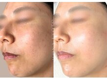 ウォナ(WONA)/【お客様症例】