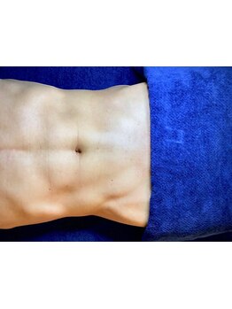 脱毛デビューにオススメのサロン