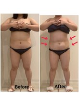 スペチアーレ 夙川/要らない脂肪はトイレに流す