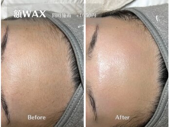 フィズアイビューティー 岡崎竜美ヶ丘店(fiz eye beauty)/オプション｜額ワックス