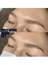 ノルジャ(NOLZA)/【HBL】ハリウッドブロウリフト