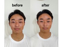 サロンR/お顔の左右差を整える小顔矯正