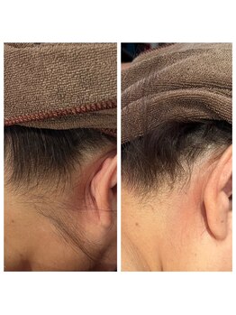 リフロ(Rifuro)/えり足美人に♪