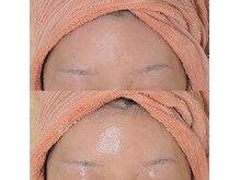 フェアリーローズ(FairyRose)の雰囲気(老化対策なら断然ハーブ&ホームケア★お肌のサビを取り除きます)