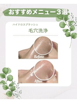 ビレボ マエバシ(BEREVO maebashi)/Before After