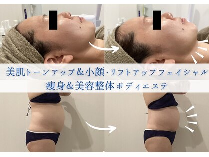 リシェルの写真