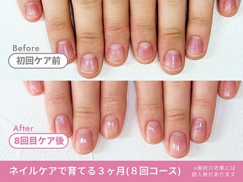 Before/After【feerie立川】