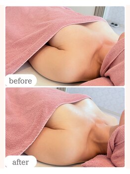 ワム(Wom)/ブラトップ愛用者さんバストケア