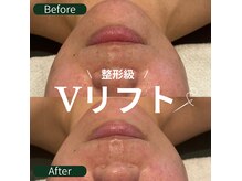 ベリア 広尾(BelLia)の雰囲気（小顔を叶える【CBDフェイシャル】浮腫み/エラ張り/食い縛り改善）