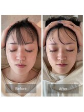 ティセ(TisseR)/脳洗浄100分ビフォーアフター