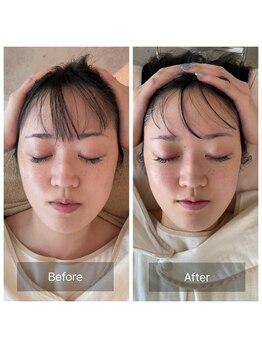 ティセ(TisseR)/脳洗浄100分ビフォーアフター