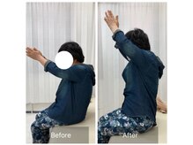 ナオル整体 三鷹院(NAORU整体)/80代女性施術事例【肩関節屈曲】