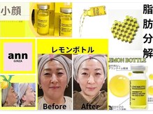 アン 銀座(ann)/レモンボトル