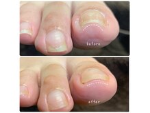 エヌドットバーバーヒロオ ネイル(N.BARBER HIROO)の雰囲気（一度のケアでも効果実感♪日々のお手入れもご相談下さい）