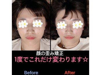 美容矯正サロン レレポノ(LELEPONO)/