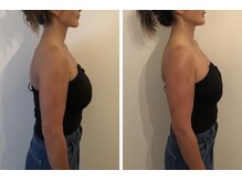 ミチカケ トリムリターン那覇市店/バストも上向きに！