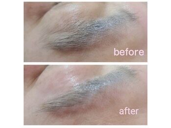 ワックス脱毛サロン アルスタ(ALUSTA)/