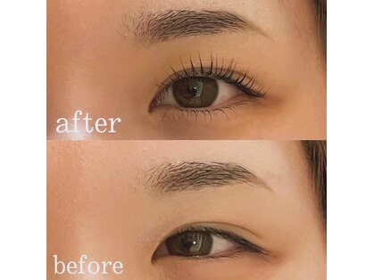 ネス イオン高松店(Nail & Esthe Shaving NES)の写真