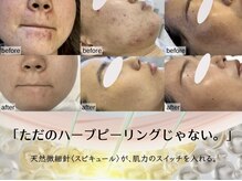 プリュボーテ(Pul Beaute)