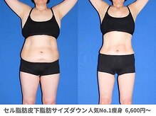 ピュアノア 垂水店/痩身ダイエット　神戸垂水明石