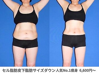 ピュアノア 垂水店/痩身ダイエット 神戸垂水明石