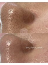 ビジュープラス ひたち野うしく店(Bijou+)/