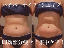 ビーグレイス(Vigrace)