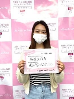 ルアナシンフォニア エクシア 池袋店(Luana-Sinfonia)/ホワイトニングビフォーアフター