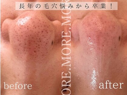 モア 吉祥寺(MORE.)の写真