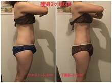 ビープロデュース 亀有店(BPRODUCE)/Before &after