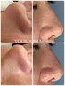 【初回体験】黒ずみ毛穴クリア×つるんと透明感UPコース15,000→6,800