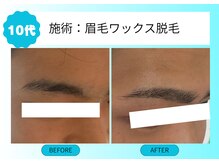 ムーンサン(Moon sun)/眉毛ワックス脱毛　メンズ