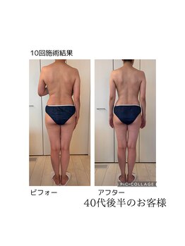 ハートエルボー(Heart elbow)/美しいボディへ