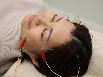 鍼灸整体院ユー(鍼灸整体院You...)/美容鍼