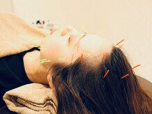 クマノミ美容鍼灸 銀座院(KUMANOMI美容鍼灸)