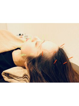 鍼灸施術を受けたい