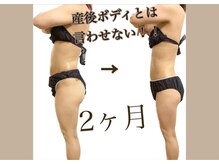 ウェリナポノビューティサロン(welina pono beauty salon)/《痩身/ダイエット/小顔》