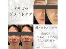 ビューティークリニックコダマ 鹿児島店の雰囲気（【鹿児島初導入】お肌のくすみトーンＵＰプラズマ光フェイシャル）